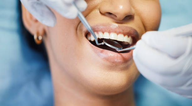 Best Broken or Chipped Tooth Repair in Brownsboro, TX